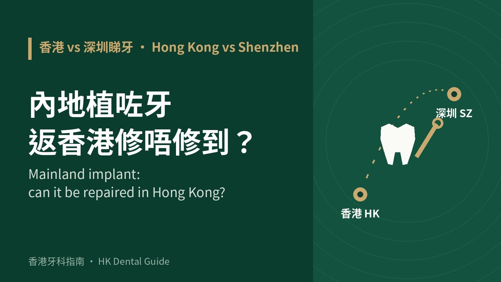 喺內地植咗牙,返香港修唔修到?植體牌子、零件同病歷要點