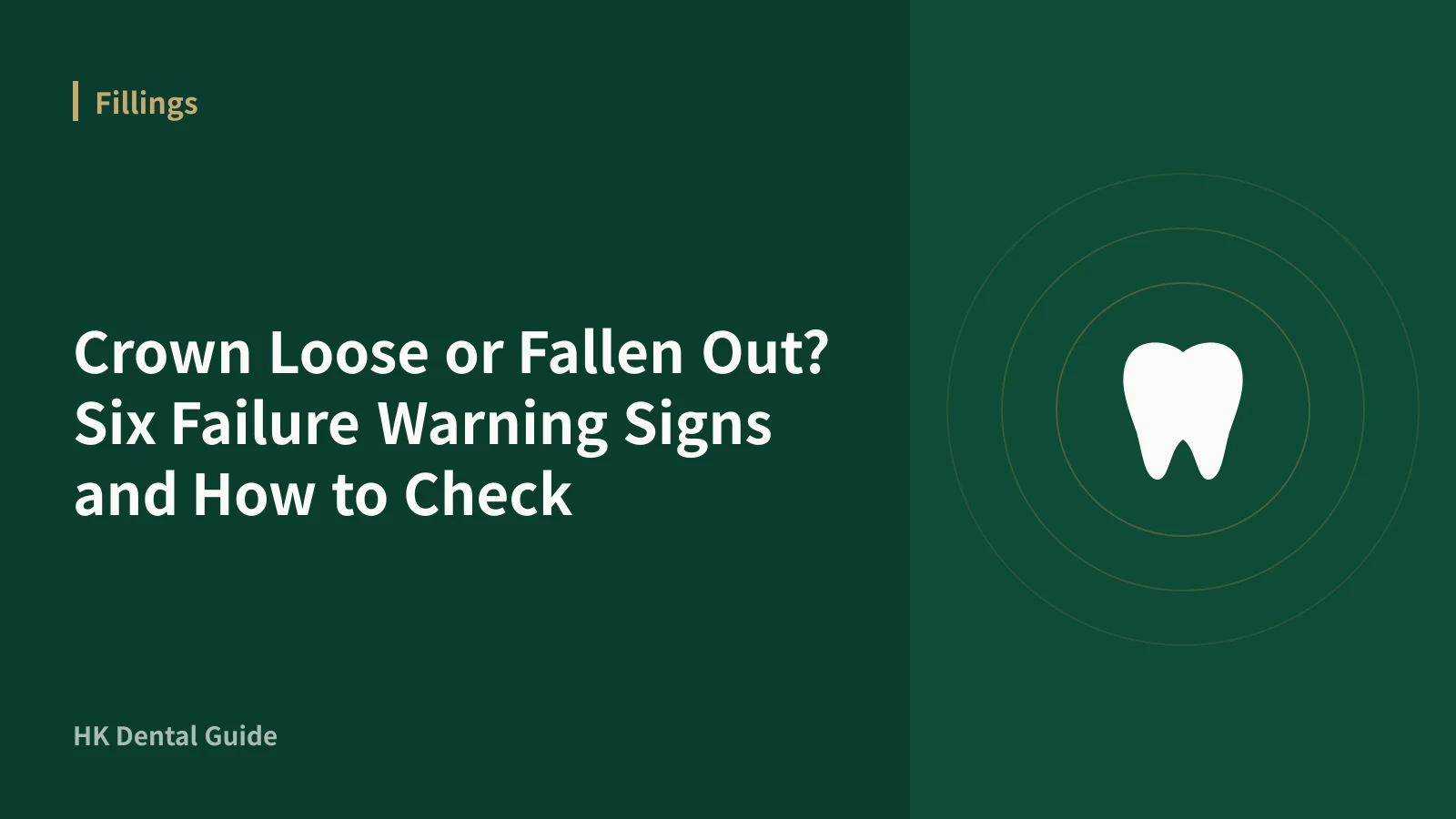 Crown Loose or Fallen Out? Six Failure Warning Signs and How to Check