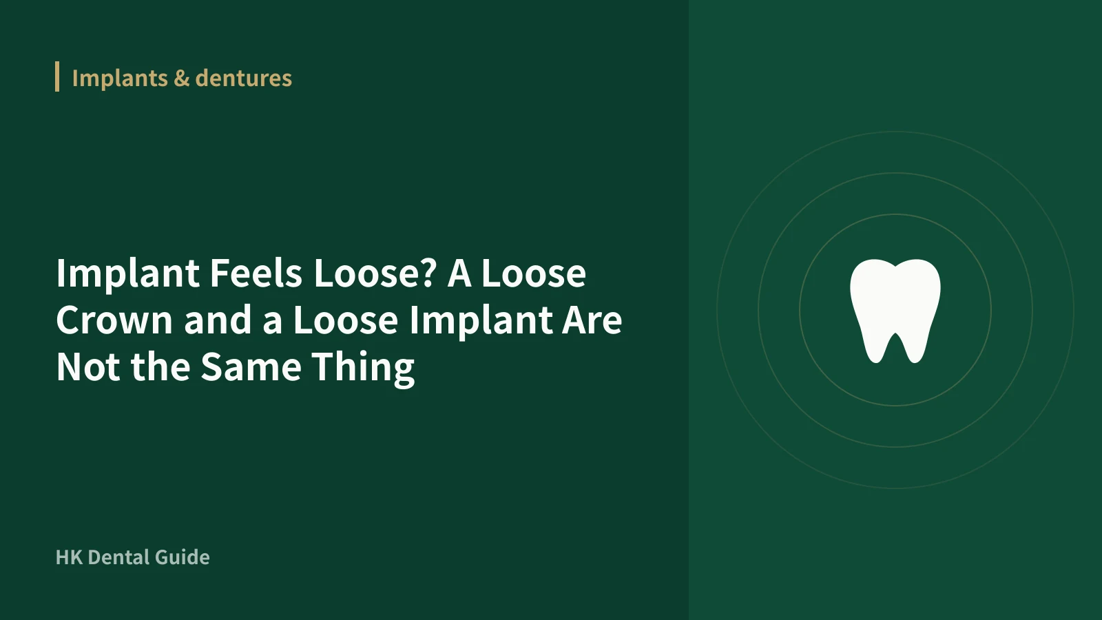 Implant Feels Loose? A Loose Crown and a Loose Implant Are Not the Same Thing