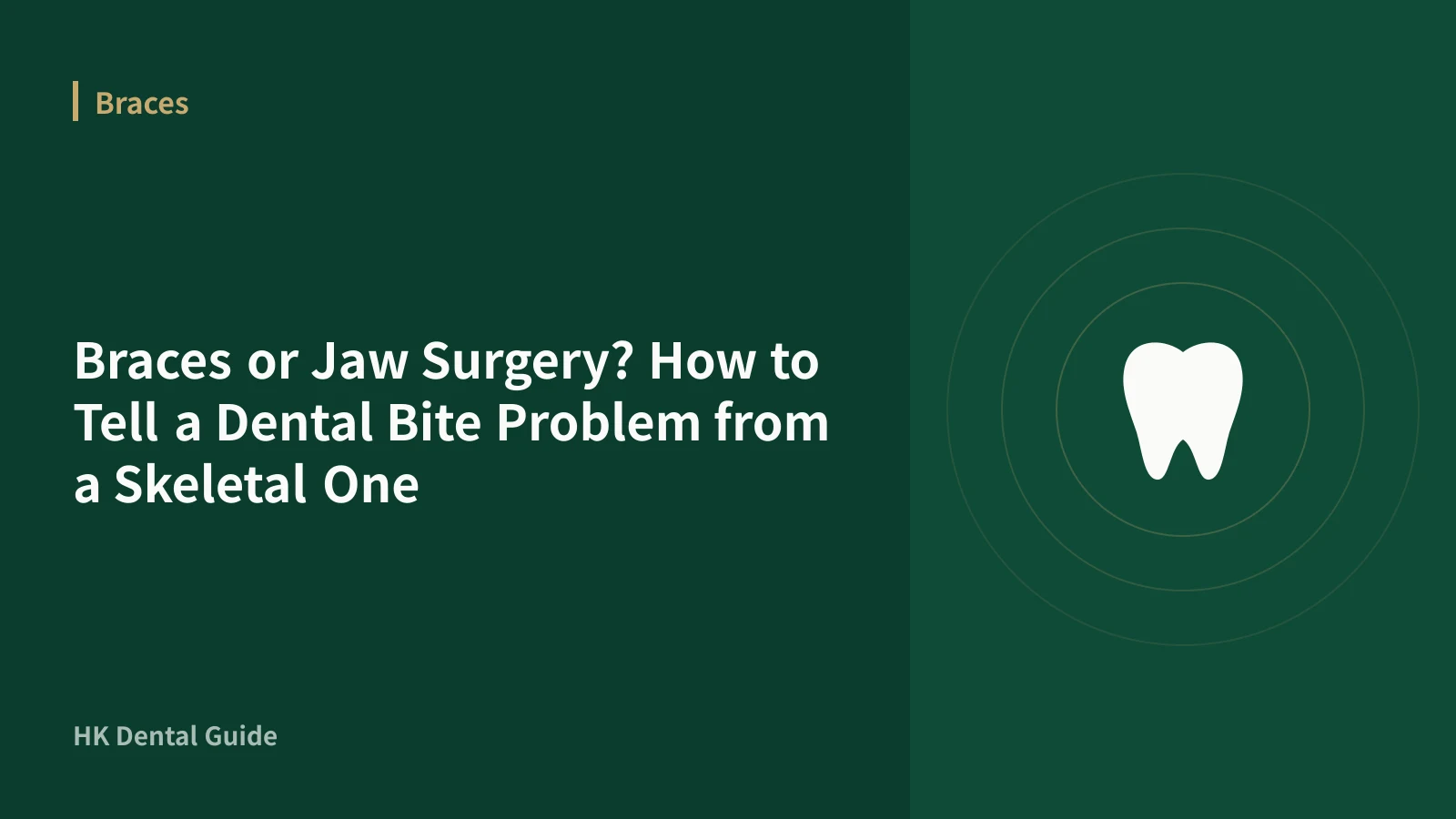 Braces or Jaw Surgery? How to Tell a Dental Bite Problem from a Skeletal One