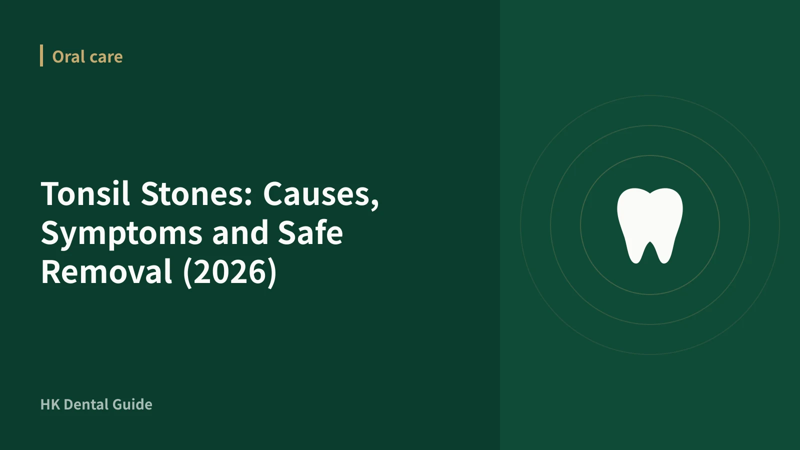 Tonsil Stones: Causes, Symptoms and Safe Removal (2026)