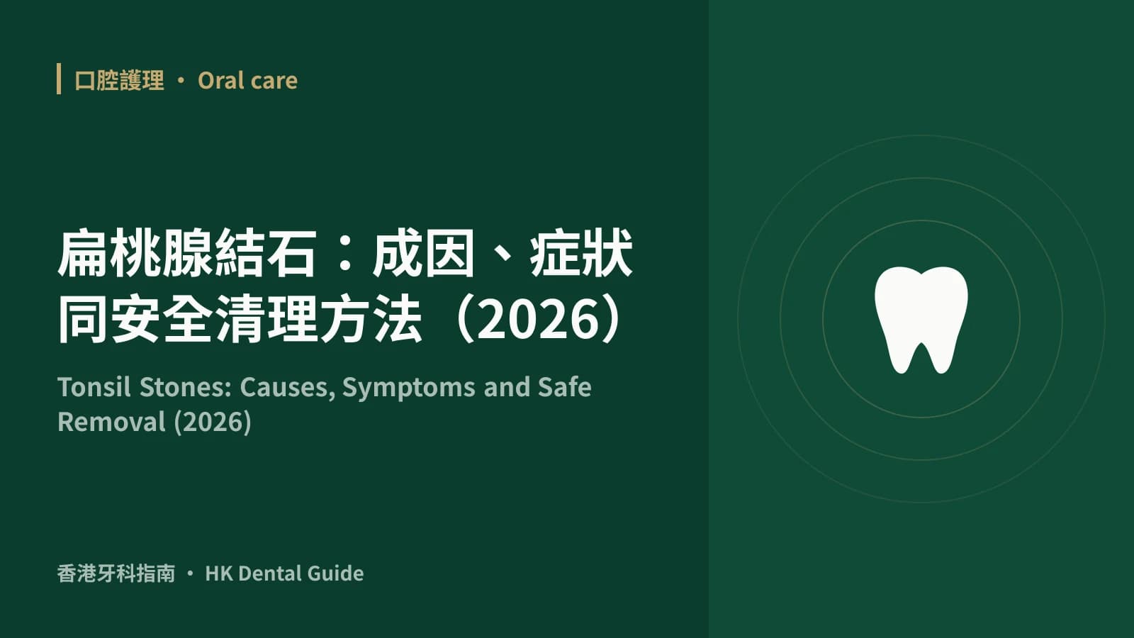 Tonsil Stones: Causes, Symptoms and Safe Removal (2026)