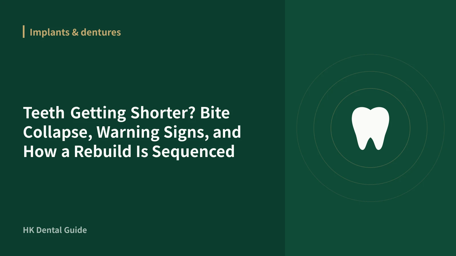 Teeth Getting Shorter? Bite Collapse, Warning Signs, and How a Rebuild Is Sequenced