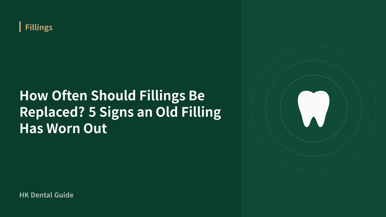How Often Should Fillings Be Replaced? 5 Signs an Old Filling Has Worn Out