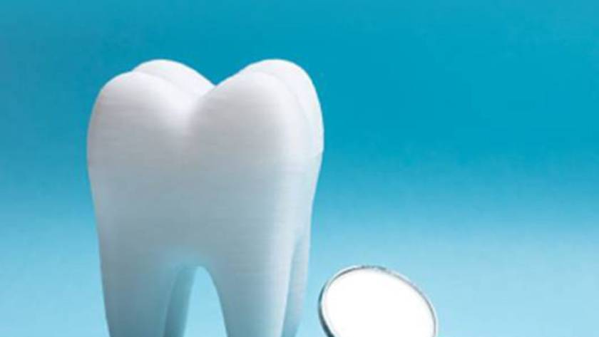 2026 香港假牙種類比較：牙橋、植牙、活動牙托優缺點及價錢全攻略 2