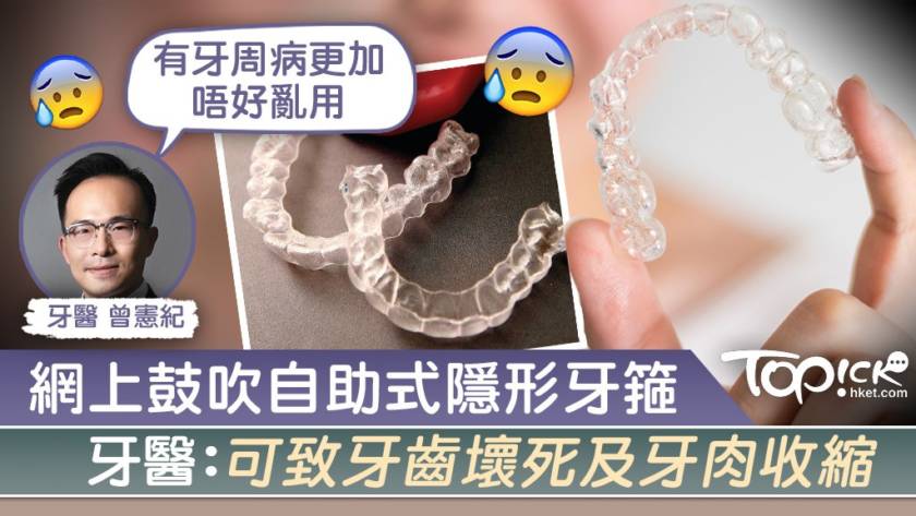 網上鼓吹自助式隱形牙箍，牙醫：嚴重可引致牙齒壞死 1