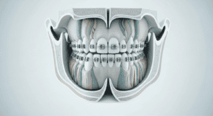 adult-orthodontics-guide-hk-2026