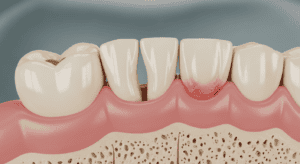 gum-problems-treatment-guide-hk