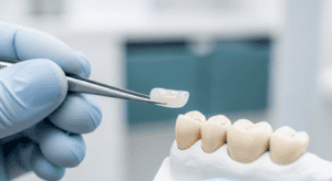 porcelain-veneers-hk-guide-2026