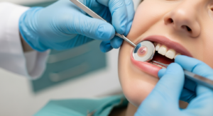 mouth-ulcer-causes-treatment-guide